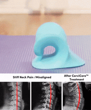 Load image into Gallery viewer, Belle&#39;s CervaCore™ Neck Pain Relief &amp; Spine Alignment Stretcher